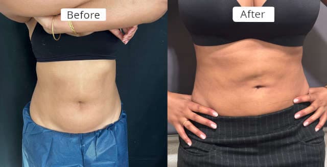 client2 - Before and After